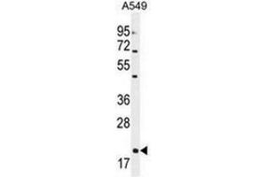 Western blot analysis of Endothelin-1  Antibody  in A549 cell line lysates (35ug/lane). (Endothelin 1 抗体  (Middle Region))