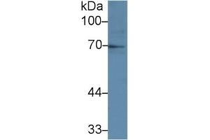 Detection of IL1R1 in Human Raji cell lysate using Polyclonal Antibody to Interleukin 1 Receptor Type I (IL1R1) (IL1R1 抗体  (AA 386-553))