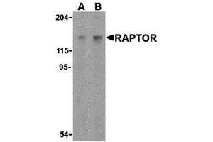 Western Blotting (WB) image for anti-RAPTOR (RAPTOR) (C-Term) antibody (ABIN1030614) (RAPTOR 抗体  (C-Term))