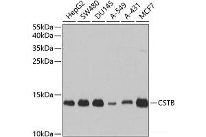 Western blot analysis of extracts of various cell lines using CSTB Polyclonal Antibody at dilution of 1:1000. (CSTB 抗体)