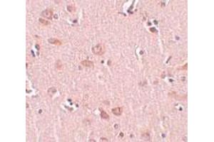 Immunohistochemical staining of human liver tissue with 5 ug/mL PLEKHM2 polyclonal antibody .