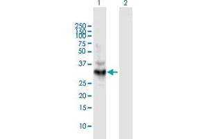 Western Blot analysis of LDHA expression in transfected 293T cell line by LDHA MaxPab polyclonal antibody. (Lactate Dehydrogenase A 抗体  (AA 1-332))