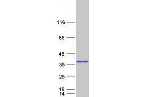 Caspase 7, Apoptosis-Related Cysteine Peptidase (CASP7) protein (Myc-DYKDDDDK Tag)