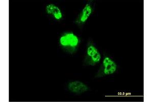 Immunofluorescence of monoclonal antibody to MGC861 on HeLa cell. (CENPM 抗体  (AA 1-180))