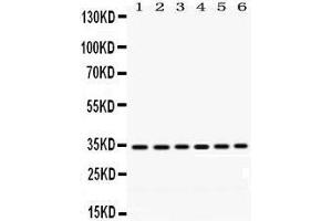 Western Blotting (WB) image for anti-Palmitoyl-Protein Thioesterase 1 (PPT1) (AA 191-224), (C-Term) antibody (ABIN3043357) (PPT1 抗体  (C-Term))