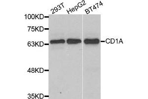 Western blot analysis of extracts of various cell lines, using CD1A antibody.