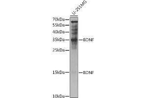 Western blot analysis of extracts of U-251MG cells, using BDNF antibody (ABIN6129991, ABIN6137522, ABIN6137524 and ABIN6215043) at 1:1000 dilution. (BDNF 抗体  (AA 20-247))