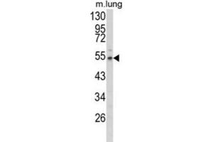 Western Blotting (WB) image for anti-Fibulin 3 (FBLN3) antibody (ABIN3004030) (FBLN3 抗体)