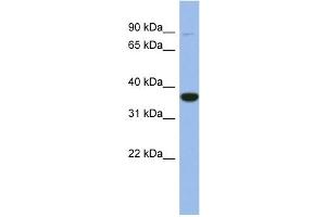 WB Suggested Anti-FANCL Antibody Titration: 0.