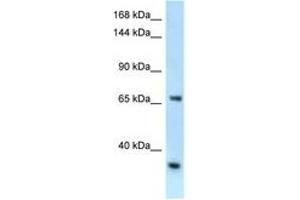 Image no. 1 for anti-RNA Binding Motif Protein 15B (RBM15B) (AA 606-655) antibody (ABIN6747437) (RBM15B 抗体  (AA 606-655))