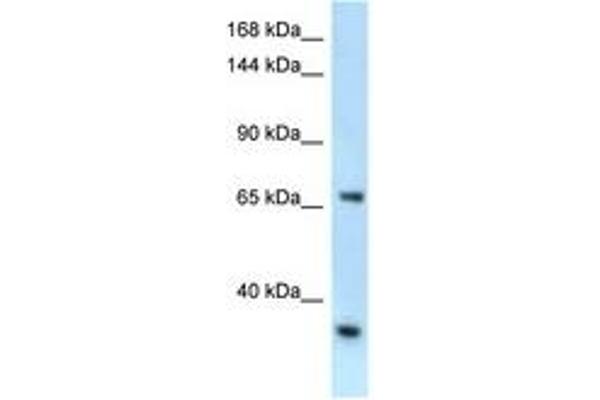 RBM15B anticorps  (AA 606-655)