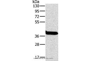 Western blot analysis of Mouse liver tissue, using OTC Polyclonal Antibody at dilution of 1:800 (OTC 抗体)