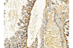 ABIN6258281 and ABIN6275236 at 1/100 staining rat testis tissue by IHC-P. (MRPS27 抗体  (N-Term))