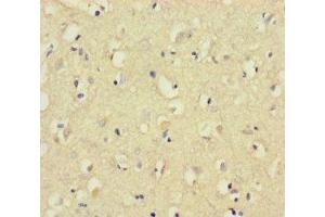 Immunohistochemistry of paraffin-embedded human brain tissue using ABIN7148826 at dilution of 1:100 (CNGA4 抗体  (AA 1-575))