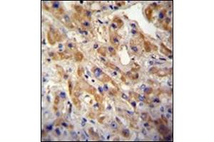 Immunohistochemistry (IHC) image for anti-Met Proto-Oncogene (MET) (Catalytic Domain) antibody (ABIN356340) (c-MET 抗体  (Catalytic Domain))