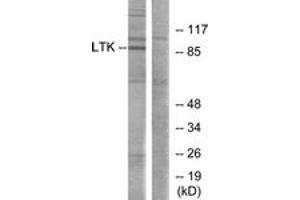 Western blot analysis of extracts from Jurkat cells, using LTK Antibody. (LTK 抗体  (AA 206-255))