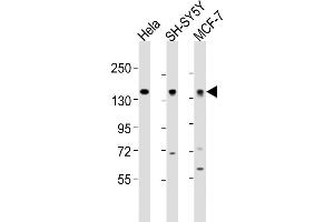 All lanes : Anti-ML2 Antibody (Center) at 1:2000 dilution Lane 1: Hela whole cell lysates Lane 2: SH-SY5Y whole cell lysates Lane 3: MCF-7 whole cell lysates Lysates/proteins at 20 μg per lane. (MAML2 抗体  (AA 780-814))