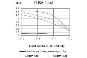 Black line: Control Antigen (100 ng),Purple line: Antigen (10 ng), Blue line: Antigen (50 ng), Red line:Antigen (100 ng) (CD7 抗体  (AA 26-180))