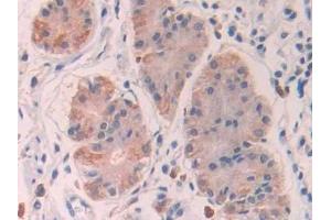 Immunohistochemistry (IHC) image for anti-Stanniocalcin 1 (STC1) (AA 28-247) antibody (ABIN7435202)