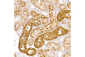 Immunohistochemistry of paraffin-embedded rat kidney using WRB Rabbit pAb (ABIN6129154, ABIN6150261, ABIN6150262 and ABIN6222768) at dilution of 1:250 (40x lens). (WRB 抗体  (AA 30-100))