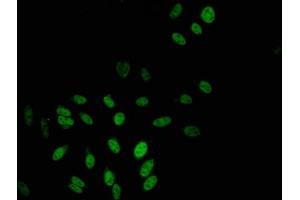 Immunofluorescent analysis of Hela cells using ABIN7152455 at dilution of 1:100 and Alexa Fluor 488-congugated AffiniPure Goat Anti-Rabbit IgG(H+L) (TBL1X 抗体  (AA 1-300))