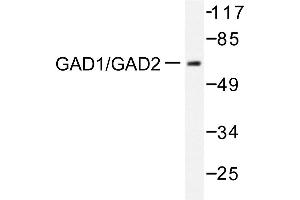 Image no. 2 for anti-Glutamate Decarboxylase 1 (Brain, 67kDa) (GAD1) antibody (ABIN271888) (GAD 抗体)