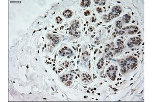 Immunohistochemical staining of paraffin-embedded breast tissue using anti-PROM2 mouse monoclonal antibody. (Prominin 2 抗体)
