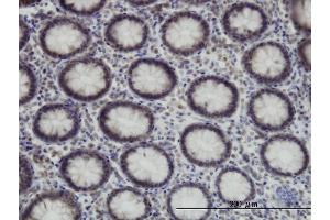 Immunoperoxidase of monoclonal antibody to SUPT5H on formalin-fixed paraffin-embedded human colon. (SUPT5H 抗体  (AA 981-1087))