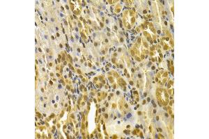 Immunohistochemistry of paraffin-embedded rat kidney using PIN1 antibody at dilution of 1:100 (x400 lens). (PIN1 抗体)