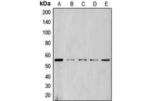 Western blot analysis of Cyclin L1 expression in HL60 (A), NIH3T3 (B), Jurkat (C), THP1 (D), K562 (E) whole cell lysates. (Cyclin L1 抗体  (C-Term))
