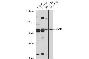 Western blot analysis of extracts of various cell lines, using M antibody (ABIN7268387) at 1:3000 dilution. (MASP2 抗体  (AA 445-686))