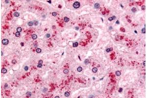 Human Liver (formalin-fixed, paraffin-embedded) stained with PYGL antibody ABIN213380 at 10 ug/ml followed by biotinylated goat anti-rabbit IgG secondary antibody ABIN481713, alkaline phosphatase-streptavidin and chromogen. (PYGL 抗体  (Internal Region))