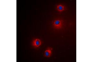 Immunofluorescent analysis of Granzyme H staining in Hela cells. (GZMH 抗体  (Center))