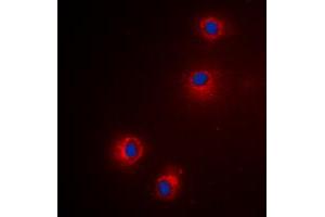 Immunofluorescent analysis of Granzyme H staining in Hela cells.