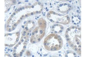 DAB staining on IHC-P; Samples: Human Kidney Tissue (IARS 抗体  (AA 1-500))