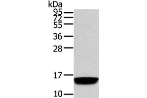 Western Blot analysis of Human normal prostate tissue using VAMP5 Polyclonal Antibody at dilution of 1/650 (VAMP5 抗体)