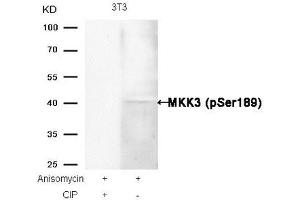Western blot analysis of extracts from 3T3 cells, treated with Anisomycin or calf intestinal phosphatase (CIP), using MKK3 (Phospho-Ser189) Antibody. (MAP2K3 抗体  (pSer189))
