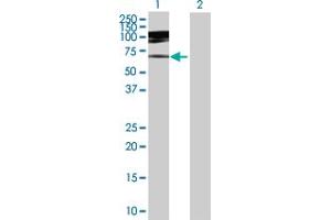 Western Blot analysis of IQWD1 expression in transfected 293T cell line by IQWD1 MaxPab polyclonal antibody. (DCAF6 抗体  (AA 1-513))