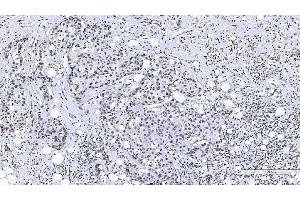 IHC analysis of FOXK1 using anti-FOXK1 antibody (ABIN7600295).