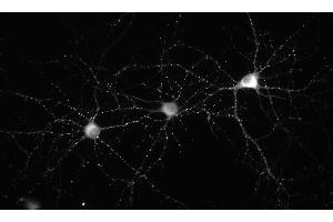 Immunofluorescence staining of 14 DIV cultured rat hippocampal neurons. (DLG2 抗体  (AA 1-852))