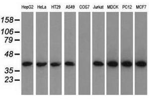 Image no. 2 for anti-Acetyl-CoA Acetyltransferase 2 (ACAT2) antibody (ABIN1496398) (ACAT2 抗体)