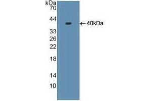 Western Blotting (WB) image for anti-Cytochrome P450, Family 17, Subfamily A, Polypeptide 1 (CYP17A1) (AA 183-508) antibody (ABIN7444709)