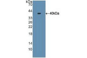 Detection of Recombinant S17aH, Human using Polyclonal Antibody to Cytochrome P450 17A1 (CYP17A1) (CYP17A1 抗体  (AA 183-508))
