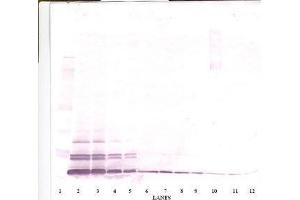 Image no. 1 for anti-Chemokine (C-C Motif) Ligand 26 (CCL26) antibody (ABIN465090) (CCL26 抗体)