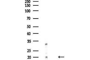 anti-Centromere Protein M (CENPM) (Internal Region) antibody