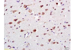 Immunohistochemistry (Paraffin-embedded Sections) (IHC (p)) image for anti-Calcium/calmodulin-Dependent Protein Kinase II beta (CAMK2B) (AA 1-100) antibody (ABIN669876)