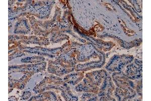 Immunohistochemistry (IHC) image for anti-Keratin 19 (KRT19) (AA 245-391) antibody (ABIN7427978)
