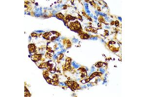 Immunohistochemistry of paraffin-embedded human placenta using HBG1 Rabbit mAb (ABIN1679149, ABIN1679148, ABIN7101336 and ABIN7101337) at dilution of 1:100 (40x lens). (HBG1/2 抗体)