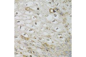 Immunohistochemistry (Paraffin-embedded Sections) (IHC (p)) image for anti-serpin Peptidase Inhibitor, Clade A (Alpha-1 Antiproteinase, Antitrypsin), Member 1 (SERPINA1) (AA 25-315) antibody (ABIN3021276)