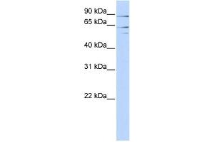 WB Suggested Anti-XPNPEP2 Antibody Titration:  0. (XPNPEP2 抗体  (Middle Region))